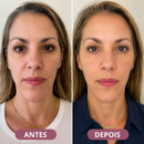 Massageador Elétrico VivaLift Antirrugas