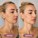 Massageador Elétrico VivaLift Antirrugas