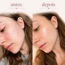 Máscara Facial Lumina Antiinchaço e Relaxante