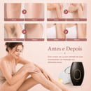 Depilador IPL Profissional Hadarea™